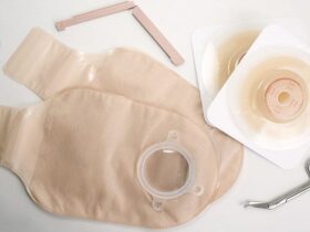 Ostomy Barrier Ring