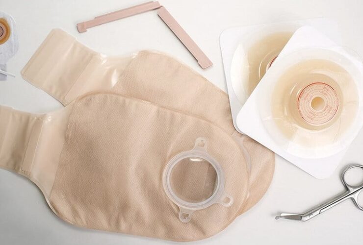 Ostomy Barrier Ring